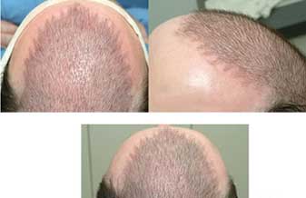 Laurindo Satoru Saito - Foto 1